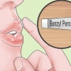 Behandl hurtigt acne omkring læberne