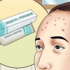 Slip af med acne på din pande