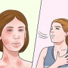 Behandling af allergier