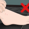 Behandling af sandloppebid