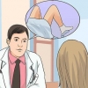 Behandling af candida