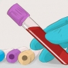 Stigende glomerulær filtrationshastighed