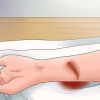 Behandling af dyb slid