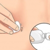 Behandling af en irriteret navlepiercing