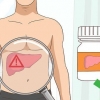 Behandling af høj alkalisk fosfatase