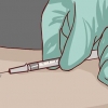 Læser en hudtest for tuberkulose