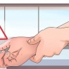 Behandling af et gigtangreb