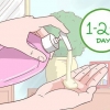 Behandling af keratosis pilaris