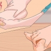 Behandling af trench feet