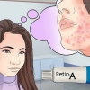 Brug af retinol