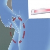 At slippe af med en svampeinfektion: kan det lade sig gøre med håndkøbsmidler?