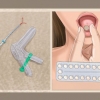 Ved hvorfor du ikke får din menstruation længere