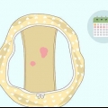 Genkendelse af unormal blødning mellem menstruation