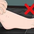 Behandling af sandloppebid