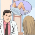 Behandling af candida