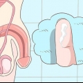 Genkendelse af symptomerne på klamydia (for mænd)