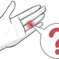 Behandling af en forslået finger