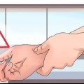 Behandling af et gigtangreb