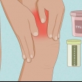 Behandling af senebetændelse i quadriceps