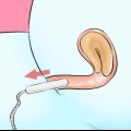 Fjern en tampon