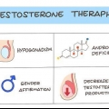 At give en testosteroninjektion