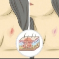 Giv en hickey