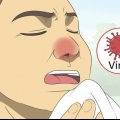 Anerkendelse af forskellen mellem bakteriel og viral tonsillitis