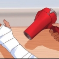 Du kradser, når du klør under dit gips