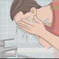 Slip af med acne på den naturlige måde