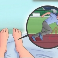 Behandling af plantar fasciitis
