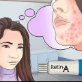 Brug af retinol