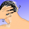 Brug af rogaine eller minoxidil