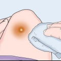 Behandl bylder