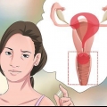 Diagnosticering af vaginalt udflåd