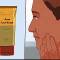 Slip af med en bums med aloe vera gel