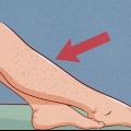 Slip af med uønsket hår