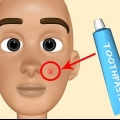 Lav din egen acne behandling