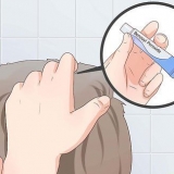 Behandl acne i din hovedbund