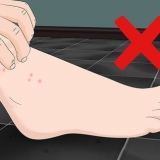 Behandling af sandloppebid