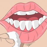 Cheilitis eksfoliative kure