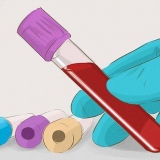 Stigende glomerulær filtrationshastighed