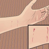 Behandling af et kattebid