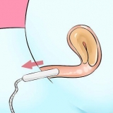 Fjern en tampon