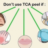 Påføring af en tca peel