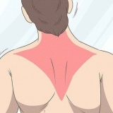 Gendannelse af en trapezius-stamme