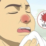Anerkendelse af forskellen mellem bakteriel og viral tonsillitis