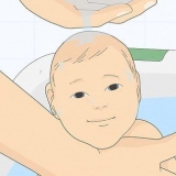 Behandling af varmeudslæt hos babyer