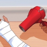 Du kradser, når du klør under dit gips