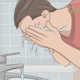 Slip af med acne på den naturlige måde