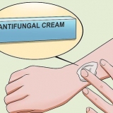 Behandl ringorm